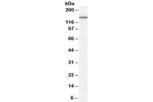 Western blot testing of human cerebellum lysate with RIG1 antibody at 0. (ROBO3 Antikörper)