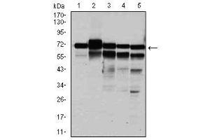 Image no. 7 for anti-Replication Protein A1, 70kDa (RPA1) antibody (ABIN1500741) (RPA1 Antikörper)