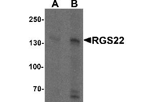 Western blot analysis of RGS22 in Jurkat cell lysate with RGS22 antibody at (A) 1 and (B) 2 µg/mL. (RGS22 Antikörper  (N-Term))