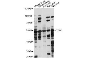 Western blot analysis of extracts of various cell lines, using TPBG antibody (ABIN6291221) at 1:1000 dilution. (TPBG Antikörper)