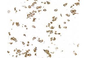 Immunocytochemistry (ICC) image for anti-CD70 Molecule (CD70) (AA 50-193) antibody (ABIN7795664)