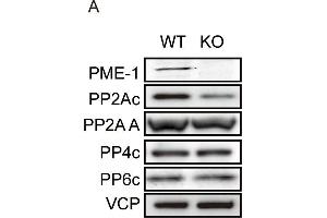 Western Blotting (WB) image for anti-Valosin Containing Protein (VCP) (N-Term) antibody (ABIN2856882)