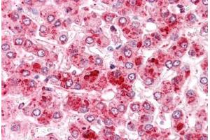 Human Liver: Formalin-Fixed, Paraffin-Embedded (FFPE) (COMT Antikörper  (N-Term))