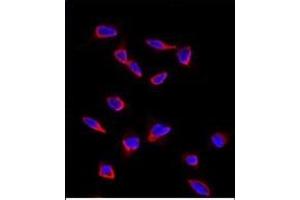 Immunofluorescence analysis of anti-SOX9 Antibody (N-term) in HeLa cells. (SOX9 Antikörper  (N-Term))