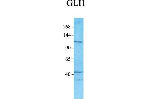 Host:  Rabbit  Target Name:  GLI1  Sample Tissue:  Human Jurkat  Antibody Dilution:  1. (GLI1 Antikörper  (C-Term))