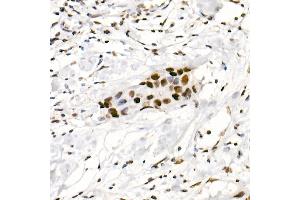 Immunohistochemistry of paraffin-embedded human placenta using DDX3X Rabbit pAb (ABIN6130252, ABIN6139494, ABIN6139495 and ABIN6221274) at dilution of 1:100 (40x lens). (DDX3X Antikörper  (AA 1-220))