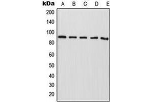 Western blot analysis of CAPRI expression in HepG2 (A), NIH3T3 (B), mouse liver (C), rat liver (D), PC12 (E) whole cell lysates. (RASA4 Antikörper  (Center))