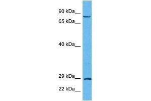 Host:  Rabbit  Target Name:  TRIM32  Sample Tissue:  Human HCT116 Whole Cell  Antibody Dilution:  1ug/ml (TRIM32 Antikörper  (C-Term))