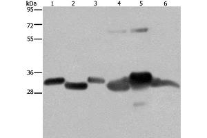 Western Blot analysis of Mouse thymus and Human ovarian cancer tissue, Mouse heart, Human fetal liver, Mouse liver tissue and SKOV3 cell using HMGCL Polyclonal Antibody at dilution of 1:300 (HMGCL Antikörper)