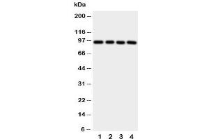 Western blot testing of Aryl hydrocarbon Receptor antibody and human samples 1:  PANC