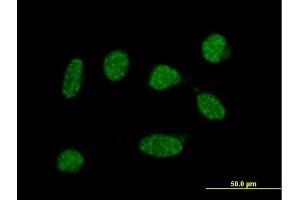 Immunofluorescence of  purified  MaxPab antibody to C19orf50 on HeLa cell. (C19orf50 Antikörper  (AA 1-176))