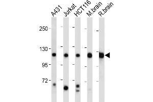 All lanes : Anti-PI3KCA Antibody (Center) at 1:2000 dilution Lane 1: A431 whole cell lysate Lane 2: Jurkat whole cell lysate Lane 3: HC whole cell lysate Lane 4: Mouse brain tissue lysate Lane 5: Rat brain tissue lysate Lysates/proteins at 20 μg per lane. (PIK3CA Antikörper  (AA 504-533))