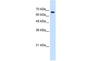 WB Suggested Anti-ZNF564 Antibody Titration:  0. (ZNF564 Antikörper  (C-Term))