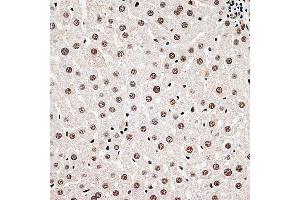 Immunohistochemistry of paraffin-embedded rat liver using CBX6 antibody (ABIN6127558, ABIN6138026, ABIN6138027 and ABIN6221185) at dilution of 1:100 (40x lens). (CBX6 Antikörper  (AA 80-180))