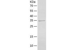 Western Blotting (WB) image for serine/threonine Kinase 16 (STK16) (AA 1-305) protein (His tag) (ABIN7125041) (STK16 Protein (AA 1-305) (His tag))