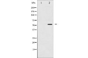 Western blot analysis of PPAR- gamma phosphorylation expression in Paclitaxel treated Jurkat whole cell lysates,The lane on the left is treated with the antigen-specific peptide.