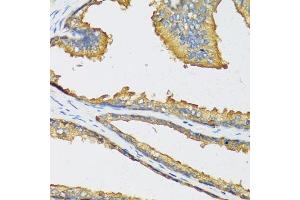 Immunohistochemistry of paraffin-embedded human prostate using CXCL11 antibody (ABIN6130151, ABIN6139269, ABIN6139270 and ABIN6221788) at dilution of 1:100 (40x lens). (CXCL11 Antikörper  (AA 22-94))