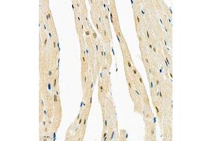 Immunohistochemistry of paraffin embedded mouse heart using COPS2 (ABIN7073324) at dilution of 1:1400 (400x lens)