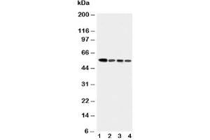 Western blot testing of Caspase-10 antibody and Lane 1:  COLO320;  2: HeLa;  3: SW620;  4: Raji cell lysate