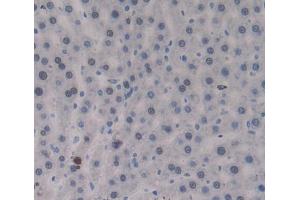 Immunohistochemistry (IHC) image for anti-Protein tyrosine Phosphatase, Receptor Type, J (PTPRJ) (AA 1033-1277) antibody (ABIN5014202)
