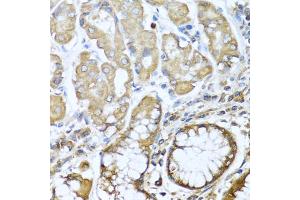 Immunohistochemistry of paraffin-embedded human stomach using NRG4 antibody (ABIN1873958) at dilution of 1:100 (40x lens). (Neuregulin 4 Antikörper)