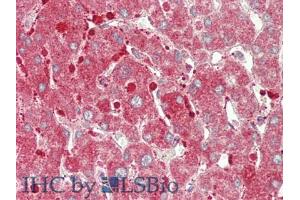 IHC-P analysis of Human Liver Tissue, with HE staining. (CPT1A Antikörper  (AA 191-353))