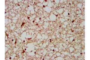 IHC image of ABIN7142166 diluted at 1:200 and staining in paraffin-embedded human brain tissue performed on a Leica BondTM system. (BCKDHA Antikörper  (AA 268-407))