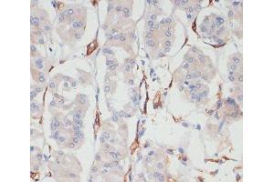 Immunohistochemistry of paraffin-embedded Human stomach using CD36 Polyclonal Antibody at dilution of 1:200 (40x lens). (CD36 Antikörper)