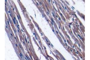 DAB staining on IHC-P; Samples: Rat Cardiac Muscle Tissue (TFAM Antikörper  (AA 43-244))