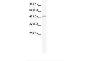 Image no. 1 for anti-DMRT-Like Family B with Proline-Rich C-terminal, 1 (DMRTB1) (AA 171-220) antibody (ABIN202289) (DMRTB1 Antikörper  (AA 171-220))