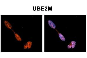 Immunohistochemistry (IHC) image for anti-Ubiquitin-Conjugating Enzyme E2M (ube2m) (N-Term) antibody (ABIN2775686)
