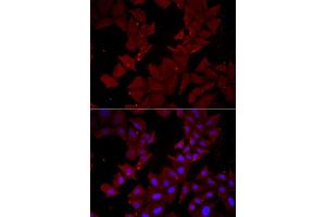 Immunofluorescence analysis of HeLa cell using CCT4 antibody. (CCT4 Antikörper)