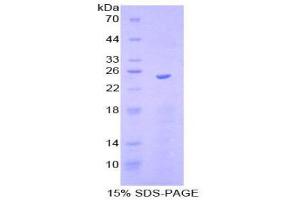 SDS-PAGE (SDS) image for Interleukin-27 Subunit alpha (IL27) (AA 29-234) protein (His tag) (ABIN2121453)