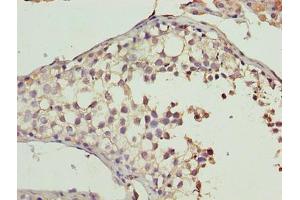 Immunohistochemistry of paraffin-embedded human testis tissue using ABIN7160978 at dilution of 1:100 (CYB5R2 Antikörper  (AA 1-237))
