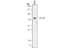 Image no. 1 for anti-Interleukin 23 Receptor (IL23R) (AA 24-354) antibody (ABIN204348) (IL23R Antikörper  (AA 24-354))