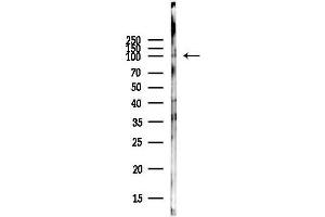 Western blot analysis of lysates from COLO205 cells(heat-shock,45 min treatment), using Phospho-DYR1A (Tyr449) Antibody at 1/1000 dilution.