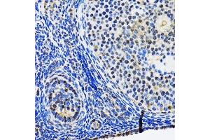 Immunohistochemistry of paraffin-embedded rat ovary using TP53 antibody. (p53 Antikörper  (AA 1-100))