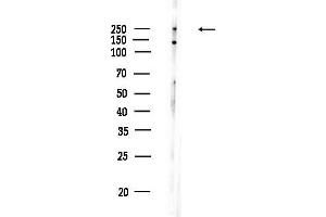 Western blot analysis of lysates from EC304 cells, using DOCK7 Antibody at 1/1000 dilution.