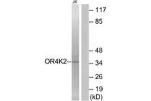 Western blot analysis of extracts from Jurkat cells, using OR4K2 Antibody.