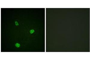 Immunofluorescence analysis of HeLa cells, using MITF (epitope around residue 180/73) antibody. (MITF Antikörper  (Ser73, Ser180))