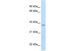Western Blot showing ZMYND11 antibody used at a concentration of 1-2 ug/ml to detect its target protein. (ZMYND11 Antikörper  (Middle Region))