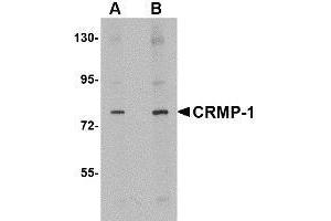 Western blot analysis of CRMP1 in rat brain tissue lysate with AP30244PU-N CRMP1 antibody at (A) 1 and (B) 2 μg/ml. (CRMP1 Antikörper  (N-Term))