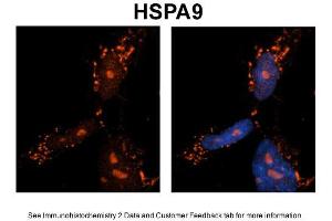 Immunohistochemistry (IHC) image for anti-Heat Shock 70kDa Protein 9 (Mortalin) (HSPA9) (C-Term) antibody (ABIN2779292)