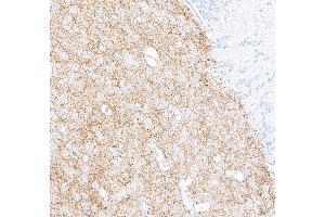 Immunohistochemistry (IHC) image for anti-Tyrosine Hydroxylase (TH) (AA 450-500) antibody (ABIN7449433) (Rekombinanter Tyrosine Hydroxylase Antikörper  (AA 450-500))