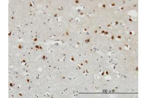 Image no. 1 for anti-Fibroblast Growth Factor 12 (FGF12) (AA 1-182) antibody (ABIN598680) (FGF12 Antikörper  (AA 1-182))