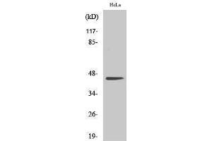 Western Blotting (WB) image for anti-Casein Kinase 2 alpha 1 (CSNK2A1) (Ser281) antibody (ABIN3174171) (CSNK2A1/CK II alpha Antikörper  (Ser281))