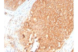 Formalin-fixed, paraffin-embedded human Pancreas stained with Topo I Rabbit Recombinant Monoclonal Antibody (TOP1MT/2883R). (Rekombinanter TOP1MT Antikörper)