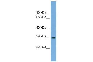 RAB40C antibody used at 1 ug/ml to detect target protein. (RAB40C Antikörper  (N-Term))