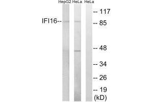 Western blot analysis of extracts from HeLa cells and HepG2 cells, using IFI16 antibody. (IFI16 Antikörper)