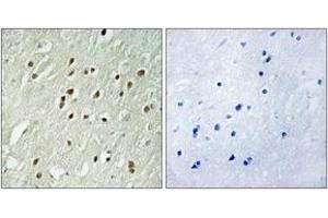 Immunohistochemistry analysis of paraffin-embedded human brain, using CNTROB Antibody. (CNTROB Antikörper  (AA 591-640))